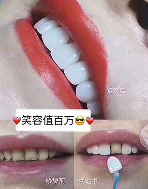 �S��������Ӗ(x��n)