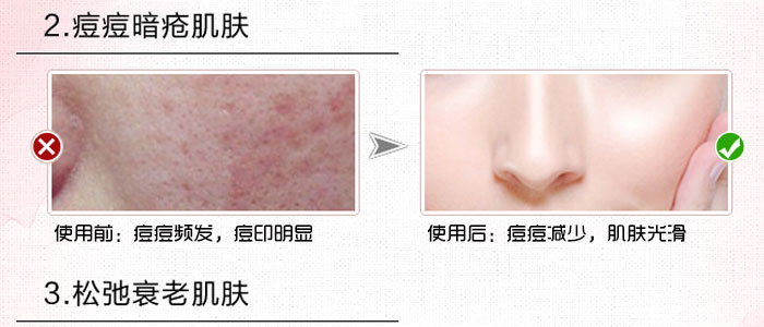 隆麗琦本草潤(rùn)白修復(fù)霜套盒 隆麗琦本草潤(rùn)白修復(fù)霜套盒