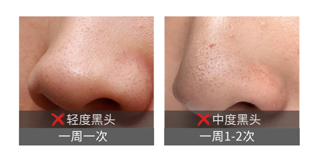 ��ɽ��ȥ���^���N