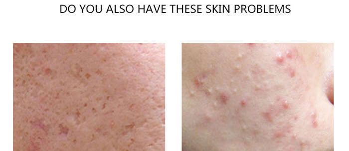 ���B(y��ng)���������o(h��)��