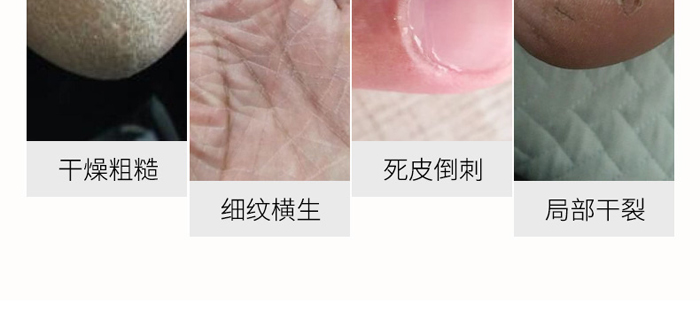 �������͸��(r��n)��˪20g