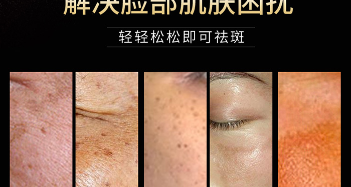 ϧ��܎����݌���